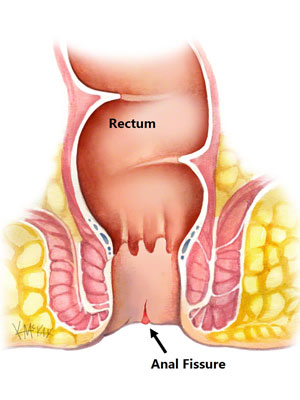 Anus specialist Surgeon in Kanpur