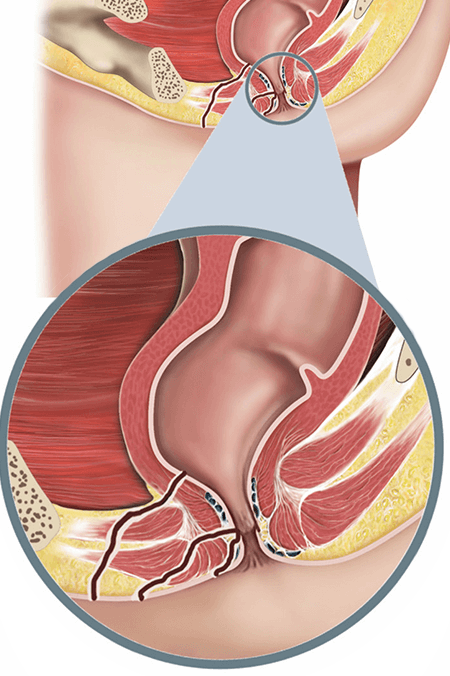 Proctologist in Kanpur