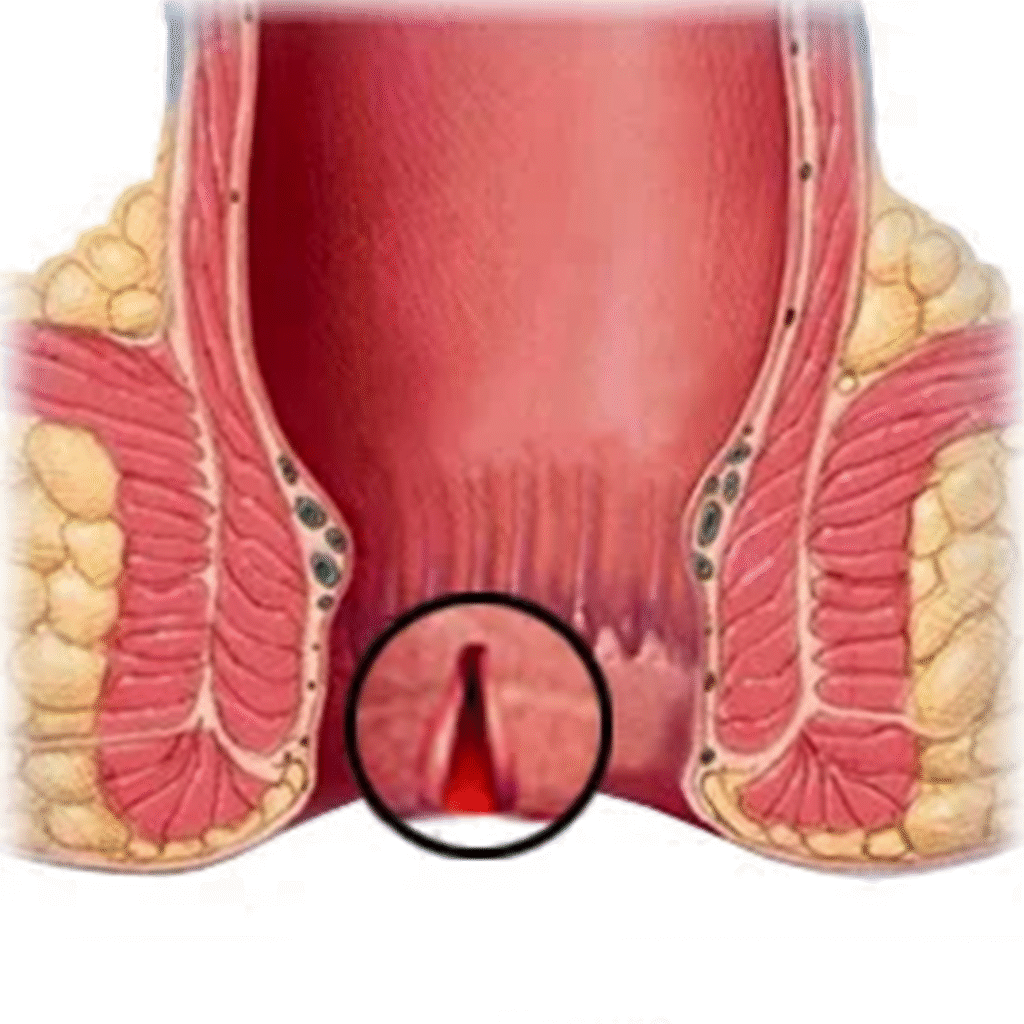 Anorectal Surgeon in Kanpur